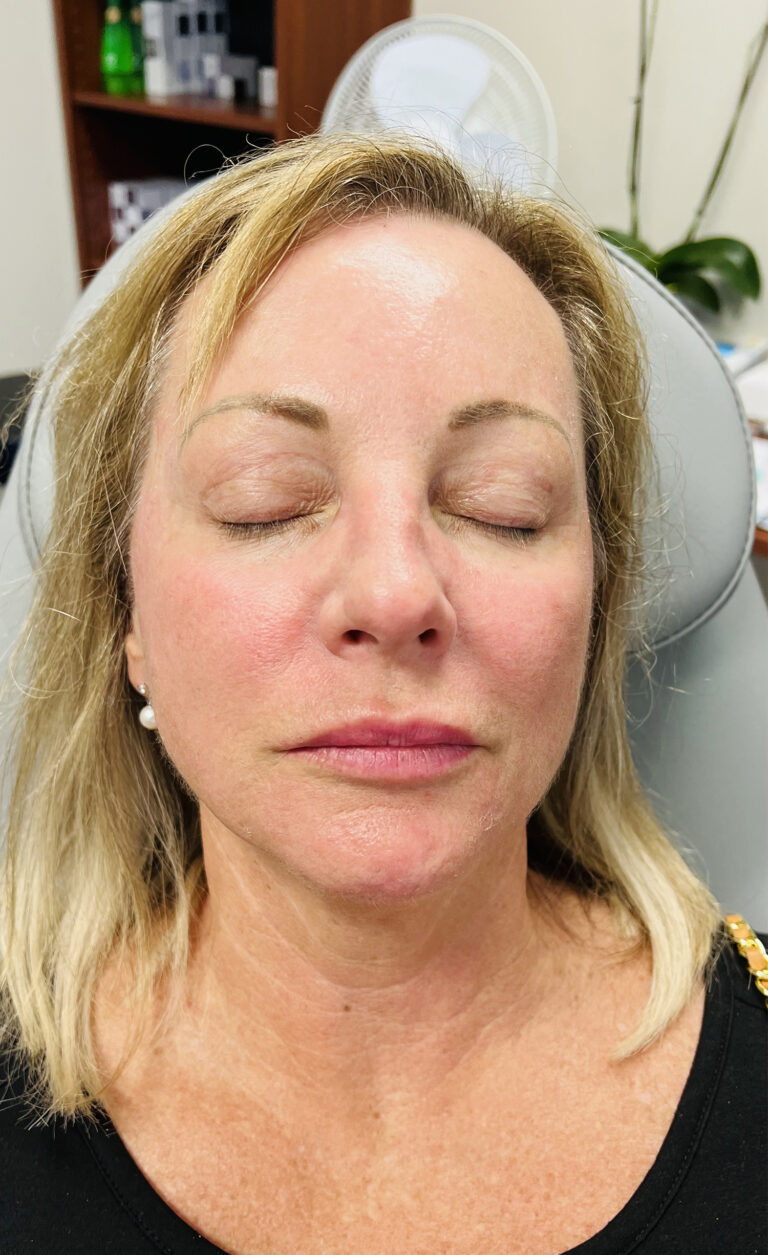 After Image: Laser Genesis - front