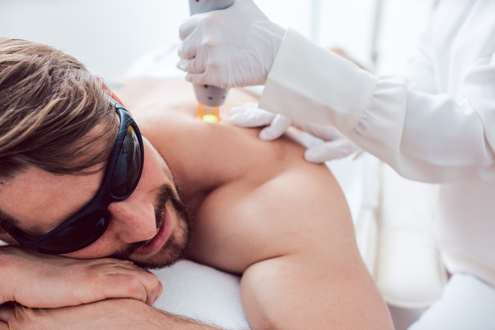 Male patient receiving Xeo+ laser therapy to treat scarring on his back.